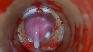 Insemination - Internal Camera Captures Deep Male Ejaculation